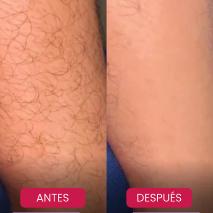 Depiladora de Cristal  ✨ DEPILACIÓN SIN DOLOR 💎 Piel Lisa y Suave por Más Tiempo