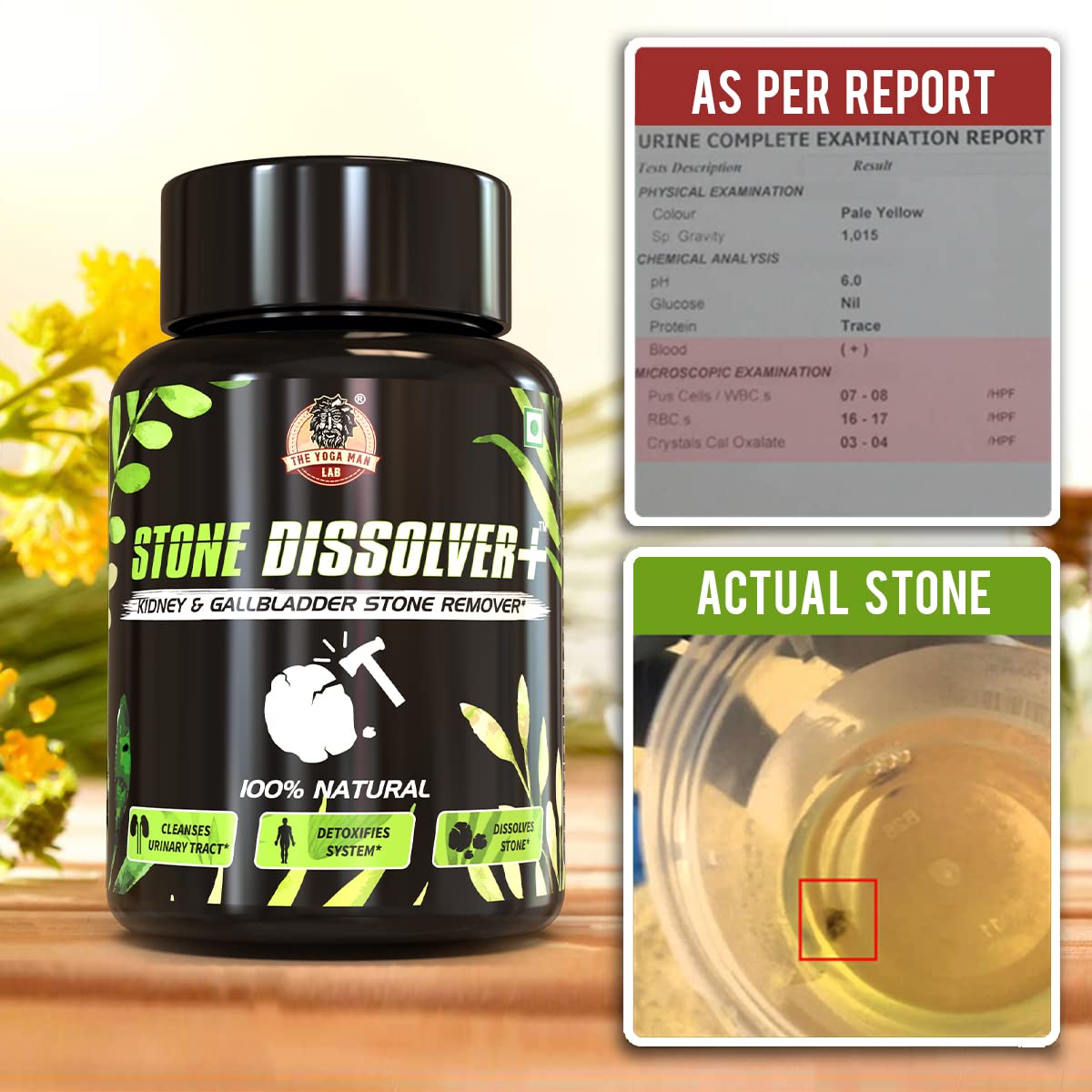 STONE DISSOLVER  🪨🔨 | Suplemento Renal para Cálculos e Infección